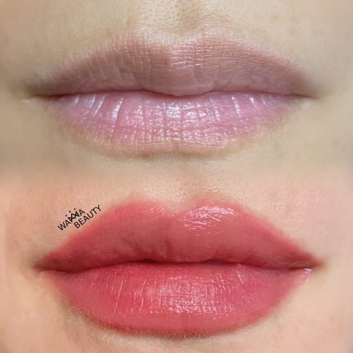 LIP ENHANCEMENT